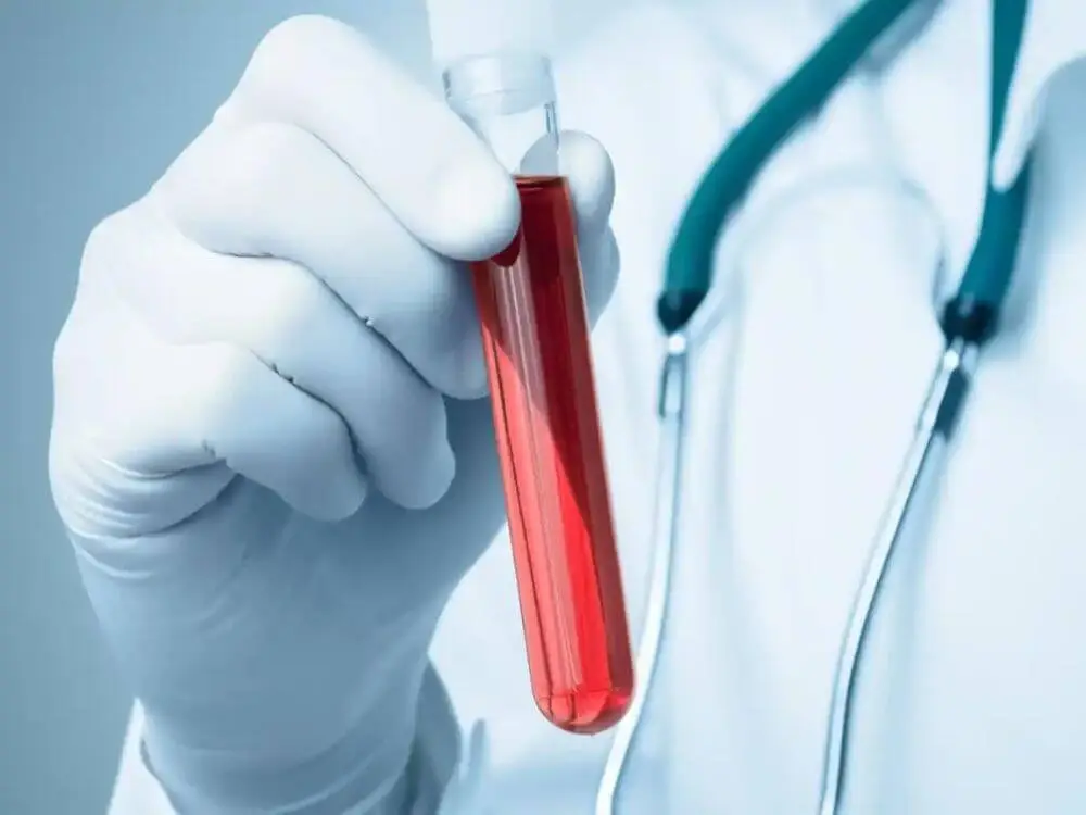 Biopsia líquida