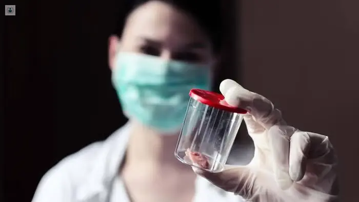 Biopsia de tejido